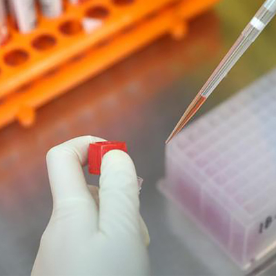 RT PCR Test Kit Monkeypox Virus MPXV CE مسجل 1 اختبار / صندوق