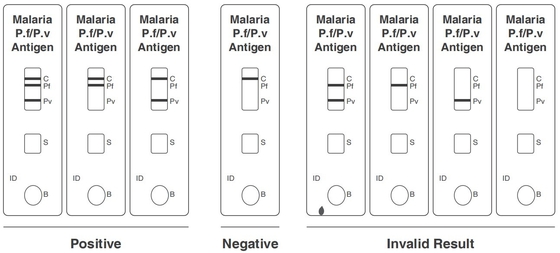 مجموعة اختبار الملاريا PF / PV Antigen السريع مسجلة بالذهب الغرواني CE